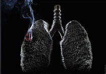 肺部.jpg