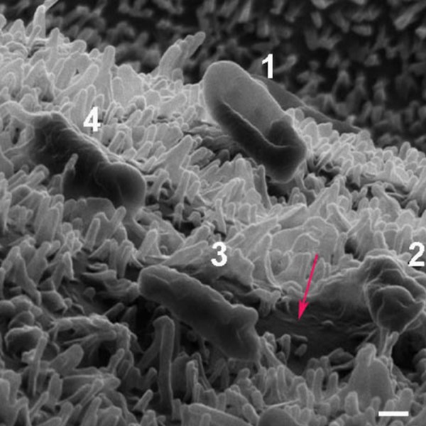 无需抗生素，蜻蜓的翅膀能够消灭细菌