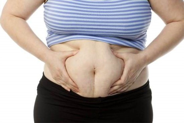 腹部脂肪堆积是妇女患癌的主要风险因素