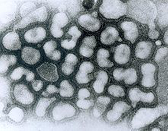 显微镜下的A型流感病毒_副本
